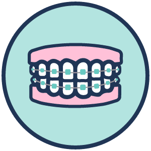 braces-closed