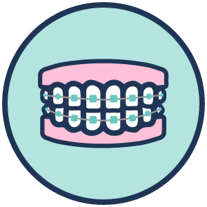 braces-closed