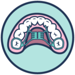 Palatal expander icon.