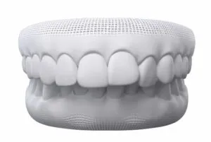 Model of an overbite