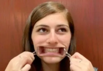 Spoons in mouth Spoons in mouth