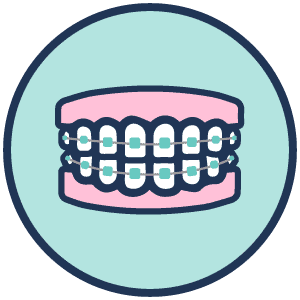 braces graphic