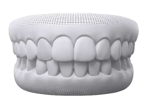 Illustration of a corrected bite at Beverly Hills Orthodontics in Beverly Hills, CA