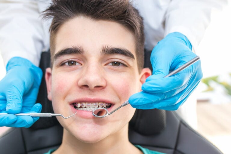 young man braces in santa monica