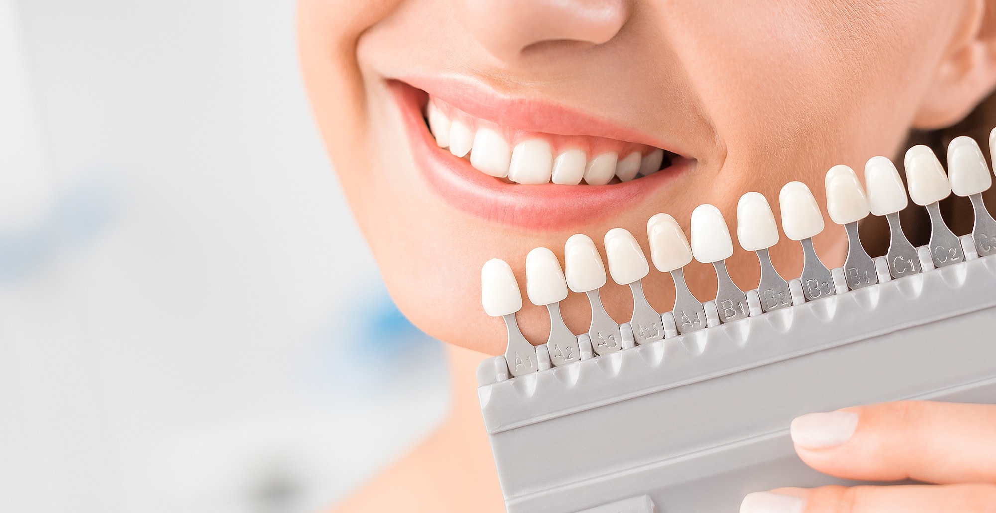 A woman holding up a tooth shade guide wondering how to keep teeth white while she has orthodontic treatment