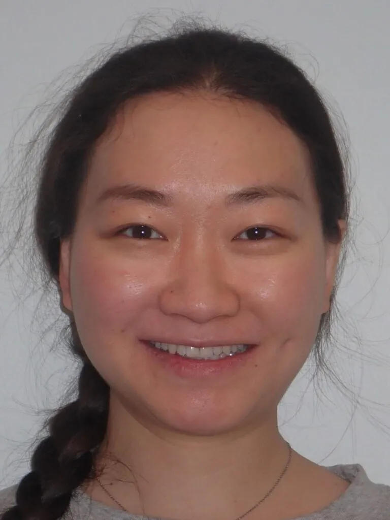 Happy orthodontic patient smiling after treatment at Beverly Hills Orthodontics in Beverly Hills, CA