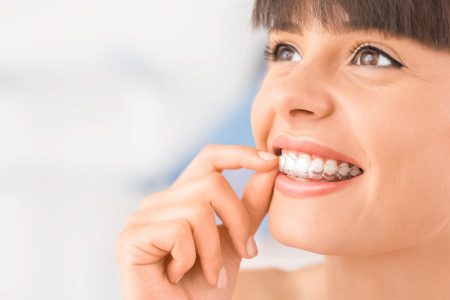 woman wearing Invisalign